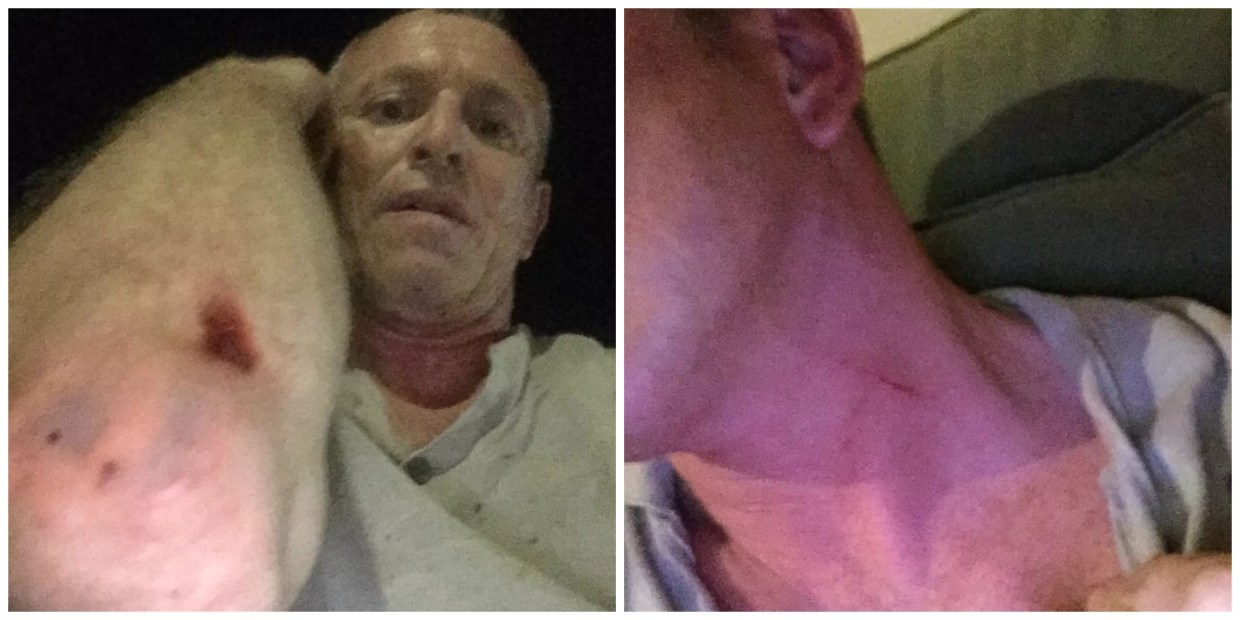 Lawsuit: Onetime Polo Model Assaulted Caretaker in West Palm