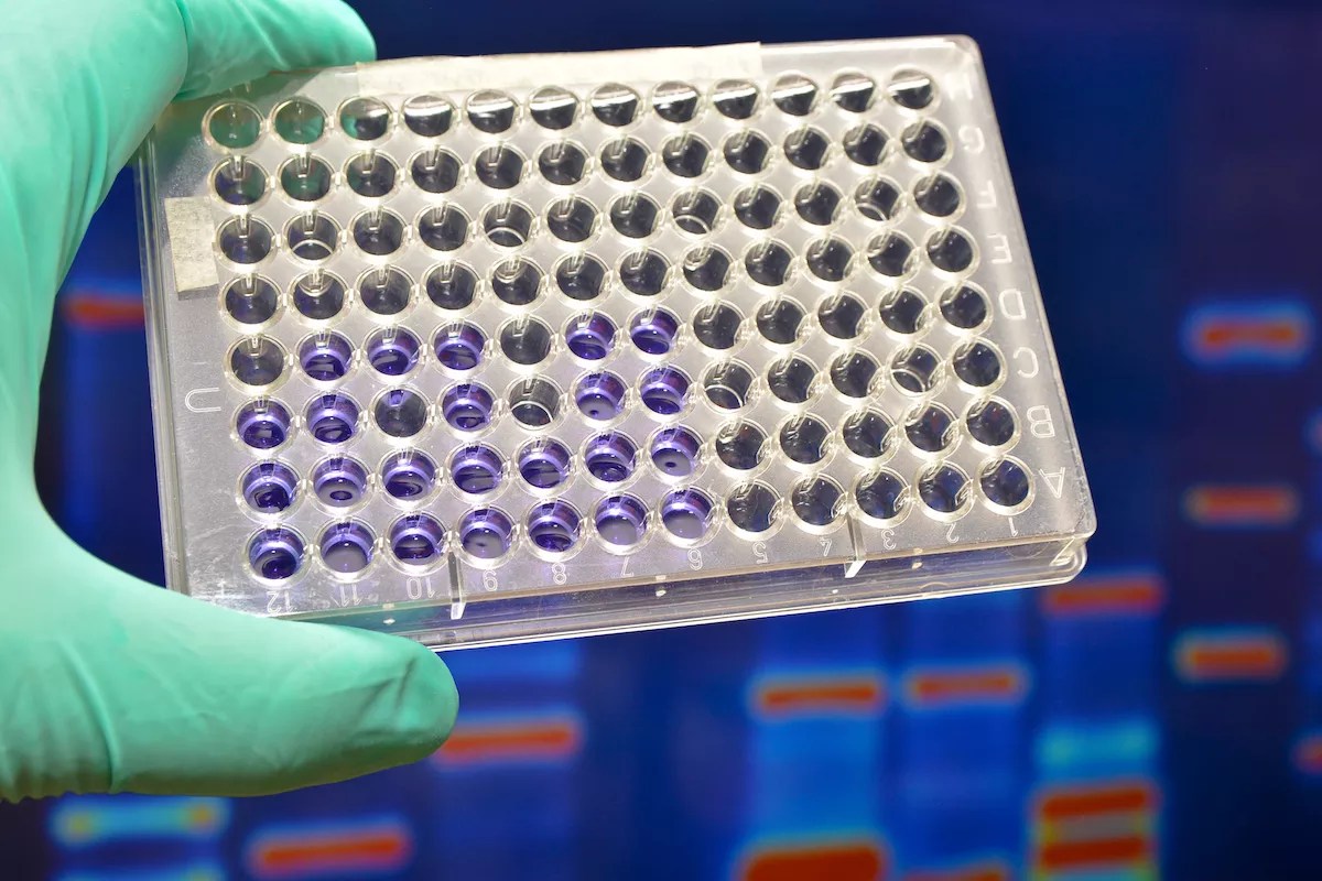 Miami Cops Plan to Use New 90-Minute DNA Tests, Alarming Civil Liberty Groups